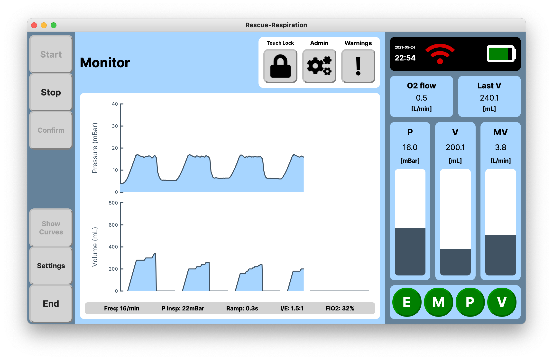 Monitor View of the ventilatior GUI